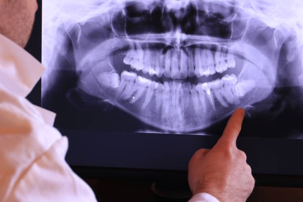 Best Emergency Treatment for Dental Infections or Abscesses in Amityville, NY
