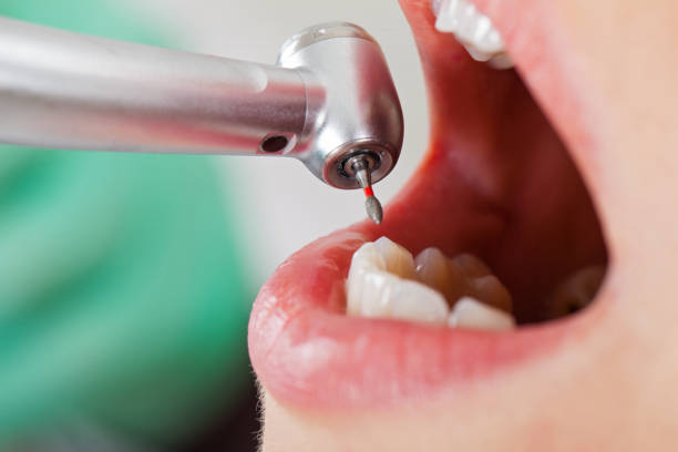 Best Emergency Denture Repair in Amityville, NY